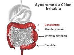 Syndrome du colon irritable solution naturelle
