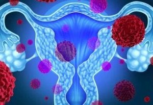 Mycose vaginale traitement naturel